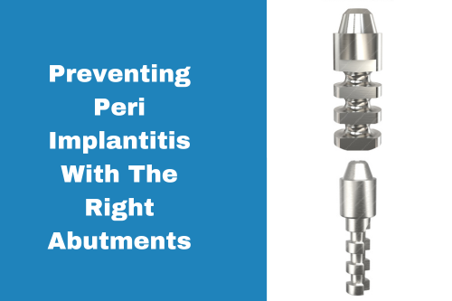 Preventing Peri Implantitis With The Right Abutments