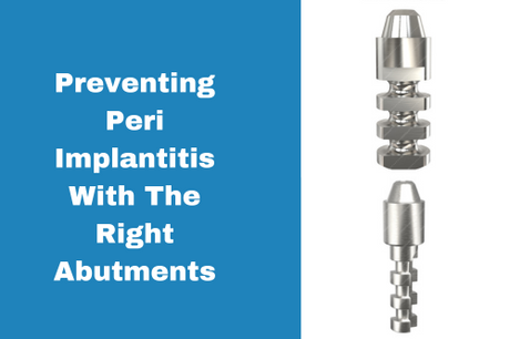 Preventing Peri Implantitis With The Right Abutments