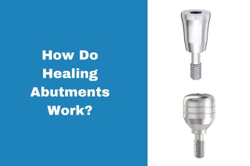 How Do Healing Abutments Work Feature Image