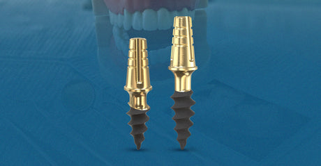 Roott® Compatible Implants: Flexible vs. Short Neck